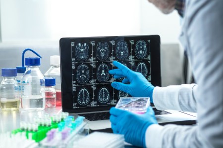 A scientist with gloves on reviewing brain scans